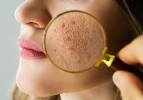 Dermatology Assessments