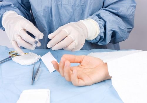 Minor Surgical Procedures